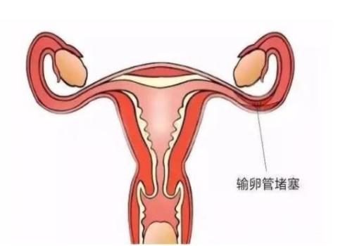 济南代怀公司：4大方法可提高弱精症做试管的成功率，1分钟即可get