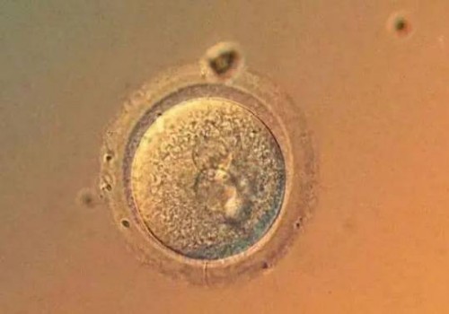 济南代怀代生：O型血怀孕生孩子要注意，小心溶血症找上门