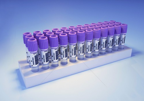 济南试管代怀生子：1分钟掌握确认妊娠单子的技巧，血HCG和B超单都在这里解读