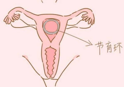 济南供卵：长沙私人试管医院怎么样,长沙哪里做试管婴儿技术最好